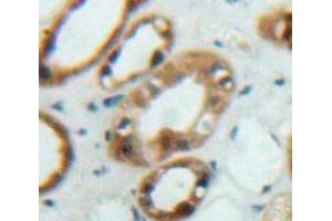 Used in DAB staining on fromalin fixed paraffin-embedded Kidney tissue (FRS2 抗体  (AA 268-453))