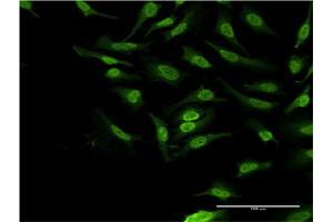 Immunofluorescence of monoclonal antibody to PBK on HeLa cell. (PBK 抗体  (AA 122-229))