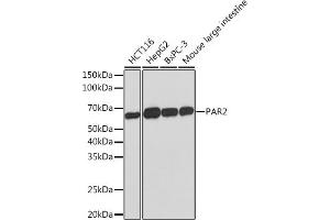 Western blot analysis of extracts of various cell lines, using P Rabbit mAb (ABIN1683023, ABIN7101760, ABIN7101761 and ABIN7101762) at 1:1000 dilution.