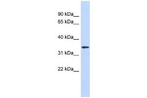 Western Blot showing OR13C5 antibody used at a concentration of 1-2 ug/ml to detect its target protein. (OR13C5 抗体  (N-Term))
