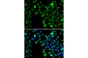 Immunofluorescence analysis of MCF-7 cells using ING5 antibody. (ING5 抗体)