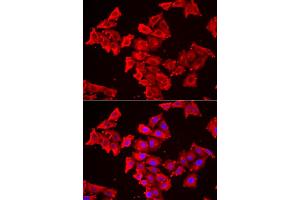 Immunofluorescence analysis of HeLa cells using SMPX antibody (ABIN6292730). (SMPX 抗体)