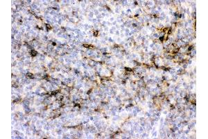 Alpha A Crystallin was detected in paraffin-embedded sections of rat spleen tissues using rabbit anti- Alpha A Crystallin Antigen Affinity purified polyclonal antibody (Catalog # ) at 1 ? (CRYAA 抗体  (AA 1-173))
