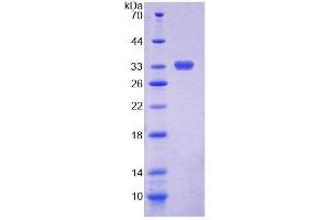 SDS-PAGE (SDS) image for Chitotriosidase (CHIT1) (AA 193-466) protein (His tag) (ABIN6237591) (Chitotriosidase 1 Protein (AA 193-466) (His tag))