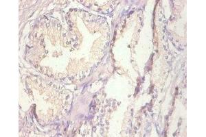 Immunohistochemistry of paraffin-embedded human prostate tissue using ABIN7159509 at dilution of 1:100