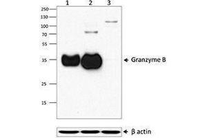 Western Blotting (WB) image for anti-Granzyme B (GZMB) (AA 21-247) antibody (ABIN2666250) (GZMB 抗体  (AA 21-247))