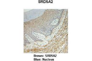 Immunohistochemistry (IHC) image for anti-Steroid-5-alpha-Reductase, alpha Polypeptide 2 (3-Oxo-5 alpha-Steroid delta 4-Dehydrogenase alpha 2) (SRD5A2) (N-Term) antibody (ABIN2781788)