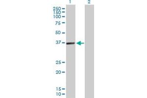 Western Blot analysis of PDLIM1 expression in transfected 293T cell line by PDLIM1 MaxPab polyclonal antibody. (PDLIM1 抗体  (AA 1-329))