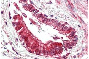 Human Lung, Respiratory Epithelium (formalin-fixed, paraffin-embedded) stained with BECN1 antibody ABIN461895 at 5 ug/ml followed by biotinylated goat anti-rabbit IgG secondary antibody ABIN481713, alkaline phosphatase-streptavidin and chromogen. (Beclin 1 抗体  (N-Term))
