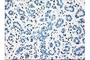 Immunohistochemical staining of paraffin-embedded breast tissue using anti-SSB mouse monoclonal antibody. (SSB 抗体)