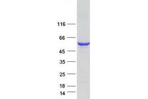 Western Blotting (WB) image for Septin 6 (SEPT6) (Transcript Variant 3) protein (Myc-DYKDDDDK Tag) (ABIN2731693)