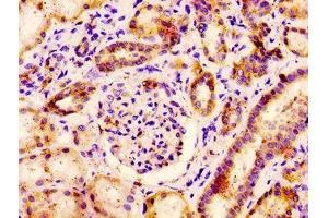 Immunohistochemistry (IHC) image for anti-Proprotein Convertase Subtilisin/kexin Type 6 (PCSK6) (AA 596-710) antibody (ABIN7164824)