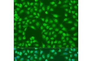 Immunofluorescence analysis of U2OS cells using COPS7A Polyclonal Antibody at dilution of 1:100. (COPS7A 抗体)