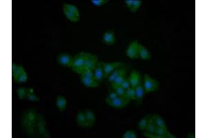 Immunofluorescence staining of HepG2 cells with ABIN7142697 at 1:200, counter-stained with DAPI. (PFKFB4 抗体  (AA 266-368))