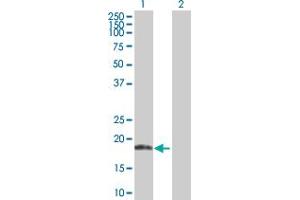 Western Blot analysis of ANK1 expression in transfected 293T cell line by ANK1 MaxPab polyclonal antibody. (Erythrocyte Ankyrin 抗体  (AA 1-155))