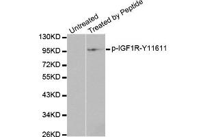 Western Blotting (WB) image for anti-Insulin-Like Growth Factor 1 Receptor (IGF1R) (pTyr1161) antibody (ABIN1870257) (IGF1R 抗体  (pTyr1161))