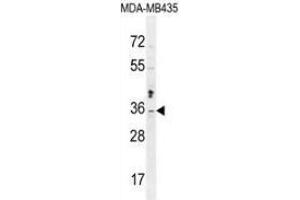 Western blot analysis in MDA-MB435 cell line lysates (35ug/lane) using Metaxin-2 Antibody (C-term). (MTX2 抗体  (C-Term))