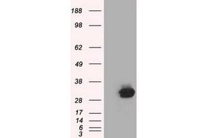 Western Blotting (WB) image for anti-Chromosome 21 Open Reading Frame 59 (C21orf59) antibody (ABIN1497042) (C21orf59 抗体)