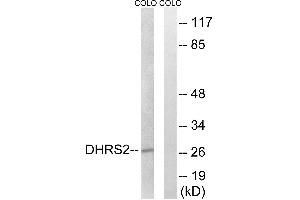 Western blot analysis of extracts from COLO cells, using DHRS2 antibody. (DHRS2 抗体)