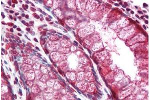 Human Colon (formalin-fixed, paraffin-embedded) stained with MUC2 antibody ABIN334258 at 5 ug/ml followed by biotinylated anti-mouse IgG secondary antibody ABIN481714, alkaline phosphatase-streptavidin and chromogen. (MUC2 抗体)