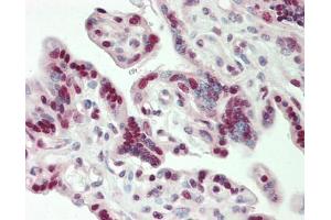 Human Placenta: Formalin-Fixed, Paraffin-Embedded (FFPE) (CBX3 抗体  (C-Term))