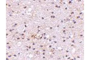 Immunohistochemistry of Ambra1 in human brain with Ambra1 antibody at 5 μg/ml. (AMBRA1 抗体  (N-Term))