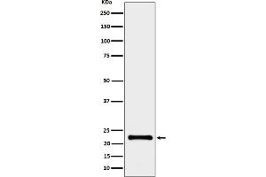 Western blot analysis of CRCP expression in HeLa cell lysate.