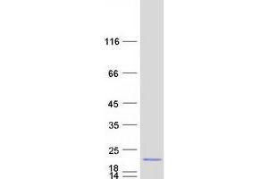 Validation with Western Blot