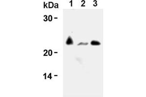 Western Blotting (WB) image for anti-CD3 (CD3) antibody (ABIN567797) (CD3 抗体)