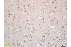 Immunohistochemistry (IHC) image for anti-Kinesin Family Member 20A (KIF20A) (AA 353-450) antibody (ABIN872316)