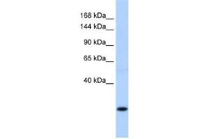 SSX8 antibody used at 0. (SSX8 抗体  (C-Term))