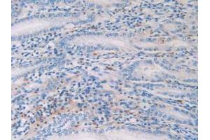 Detection of HIST1H2AG in Human Stomach Tissue using Polyclonal Antibody to Histone Cluster 1, H2ag (HIST1H2AG) (HIST1H2AG 抗体  (AA 1-130))