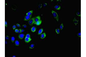 Immunofluorescent analysis of A549 cells using ABIN7159710 at dilution of 1:100 and Alexa Fluor 488-congugated AffiniPure Goat Anti-Rabbit IgG(H+L) (MFAP3L 抗体  (AA 29-102))