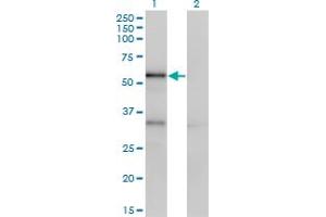 Western Blotting (WB) image for anti-serpin Peptidase Inhibitor, Clade A (Alpha-1 Antiproteinase, Antitrypsin), Member 10 (SERPINA10) (AA 22-444) antibody (ABIN565548)
