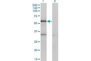 Western Blot analysis of SERPINA10 expression in transfected 293T cell line by SERPINA10 monoclonal antibody (M02), clone 1E11. (SERPINA10 抗体  (AA 22-444))