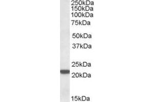 Western Blotting (WB) image for anti-Proteasome (Prosome, Macropain) Subunit, beta Type, 8 (Large Multifunctional Peptidase 7) (PSMB8) (C-Term) antibody (ABIN571001)