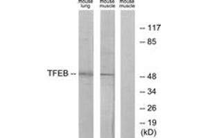 Western blot analysis of extracts from mouse lung/mouse muscle cells, using TFEB Antibody. (TFEB 抗体  (AA 10-59))