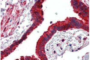 Anti-MMP14 antibody IHC of human lung, respiratory epithelium. (MMP14 抗体  (AA 160-173))