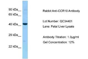 Host: Rabbit Target Name: CCR10 Sample Type: Fetal Liver Antibody Dilution: 1. (CCR10 抗体  (Middle Region))