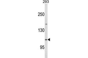 Western blot analysis of ESPN Antibody (N-term) in 293 cell line lysates (35ug/lane). (Espin 抗体  (N-Term))