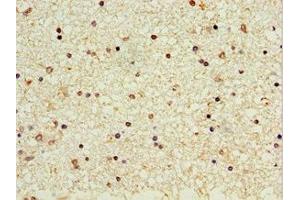 Immunohistochemistry of paraffin-embedded human brain tissue using ABIN7162964 at dilution of 1:100 (CROT 抗体  (AA 1-87))