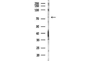 Western blot analysis of lysates from PC12 cells(starvation 24h treatment), using GNPAT Antibody at 1/1000 dilution.