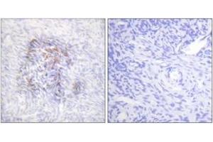 Immunohistochemistry analysis of paraffin-embedded human ovary, using IREB1 (Phospho-Ser138) Antibody. (Aconitase 1 抗体  (pSer138))