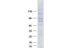 Validation with Western Blot