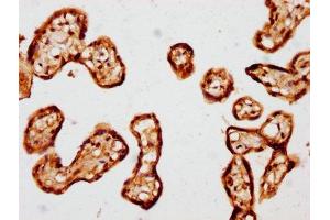 IHC image of ABIN7172758 diluted at 1:441 and staining in paraffin-embedded human placenta tissue performed on a Leica BondTM system. (TEAD1 抗体  (AA 135-215))