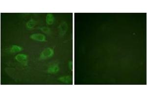 Immunofluorescence analysis of HeLa cells, using IL-2R alpha/CD25 (Phospho-Ser268) Antibody. (CD25 抗体  (pSer268))