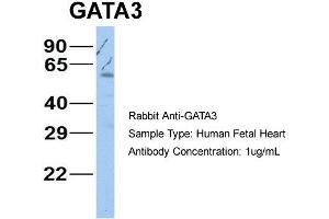 Western Blotting (WB) image for anti-GATA Binding Protein 3 (GATA3) (N-Term) antibody (ABIN2777460)