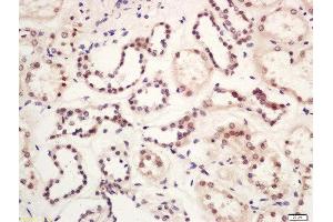 Formalin-fixed and paraffin embedded human kidney labeled with Rabbit Anti-GLIS3 Polyclonal Antibody, Unconjugated (ABIN2174444) at 1:200 followed by conjugation to the secondary antibody and DAB staining (GLIS3 抗体  (AA 101-200))