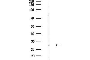 anti-Interleukin 15 Receptor, alpha (IL15RA) (Internal Region) antibody