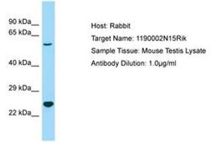 Image no. 1 for anti-Chromosome 3 Open Reading Frame 58 (C3ORF58) (AA 85-134) antibody (ABIN6749934) (C3orf58 抗体  (AA 85-134))